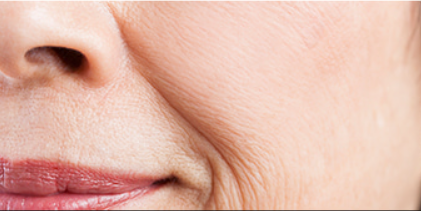 Close-up of a person's face with visible skin texture and lines.