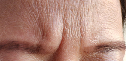 Close-up of a person's eye with visible wrinkles and skin texture.