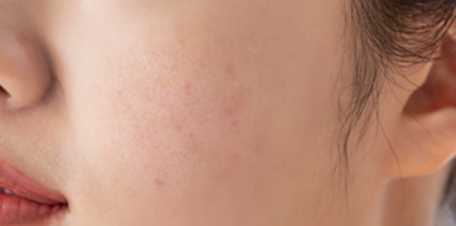 Close-up of a person's ear and part of their face with visible skin texture.