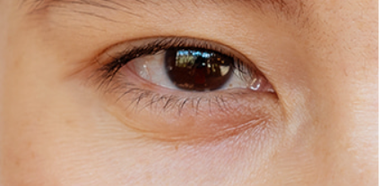 Close-up of a person's eye with a clear background