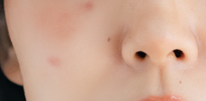 Close-up of a person's nose with visible pores and skin texture.