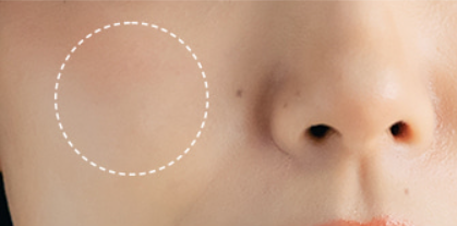 Close-up of a person's face with a focus on the nose area.