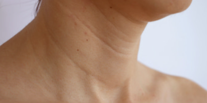 Close-up of a person's neck and shoulders with a plain background