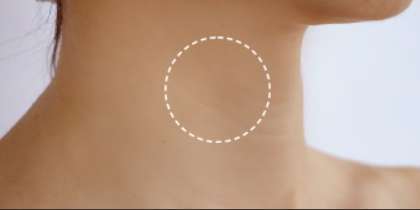 Close-up of a neck with a dotted line circle, likely indicating a treatment area.