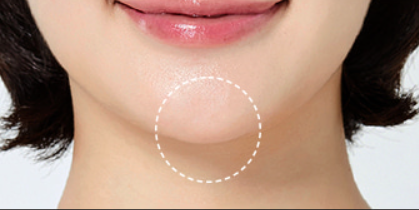 Close-up of a person's chin with a white circle highlighting the area.